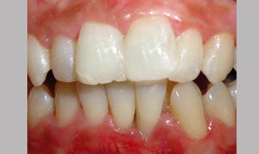 Dental hospital in Anand
                